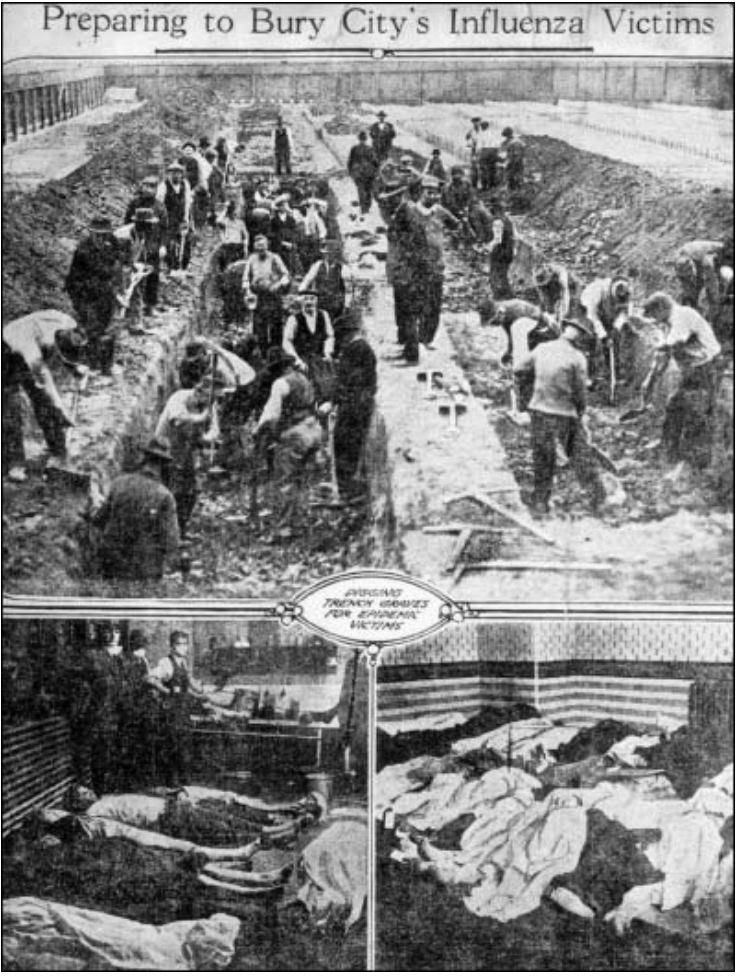 Flu Spanyol 1918, “Influenza” yang Menelan Korban Ratusan Juta Jiwa